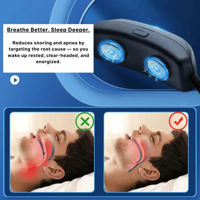 SleepClear | Anti Snoring Neurostimulation Device